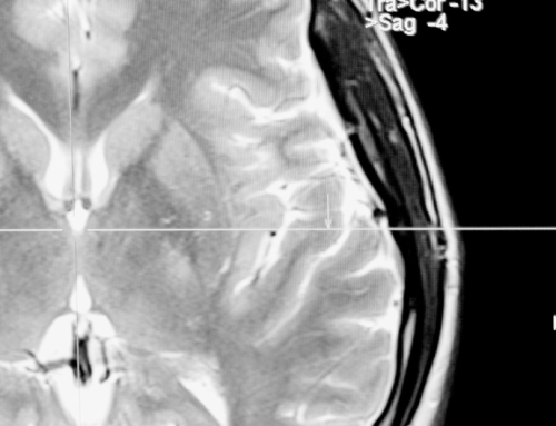 From idea to certification: regulatory readiness for medical software